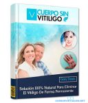 Cuerpo Sin Vitiligo